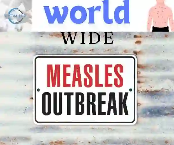 MEASLES OUTBREAK